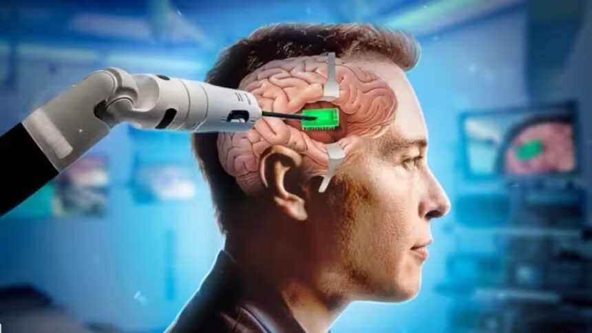 Computer Chip Will Be Installed In Human Brain, Elon Musk's Company Got ...